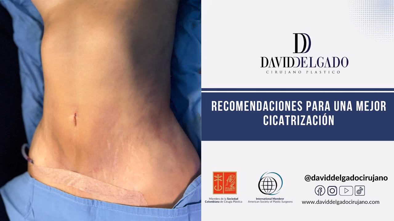 ¿Cuánto tiempo después de una cirugía se deja un apósito?