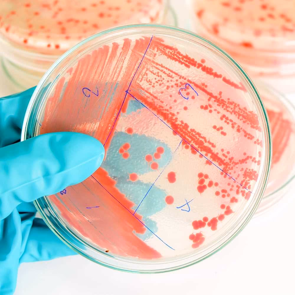 ¿Por qué estudiar microbiología?