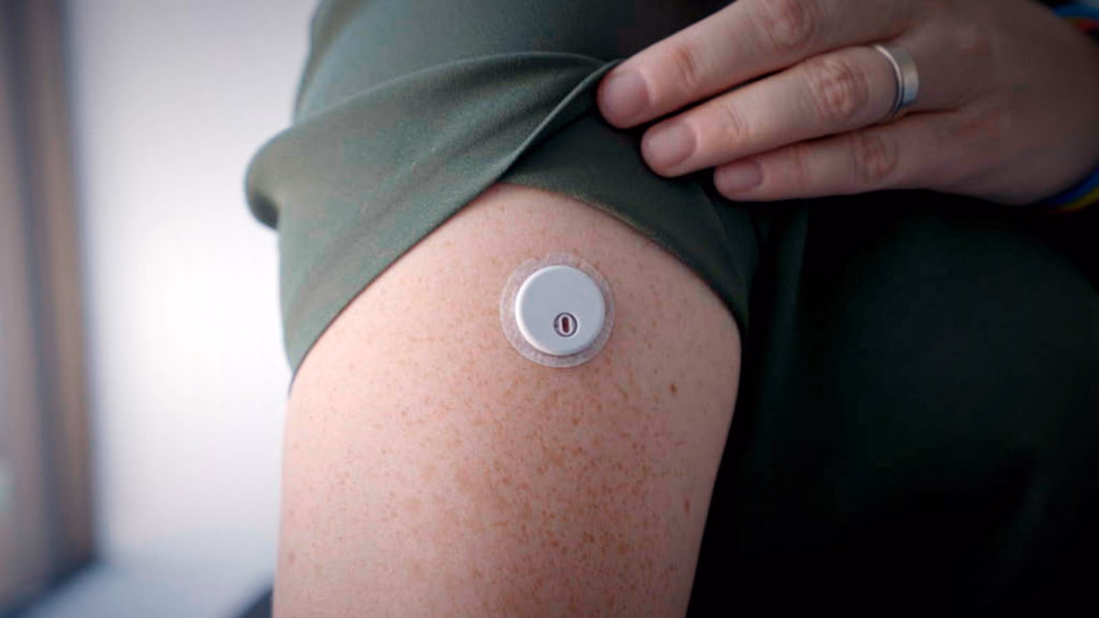 Is the FreeStyle Libre a good glucose monitoring system?