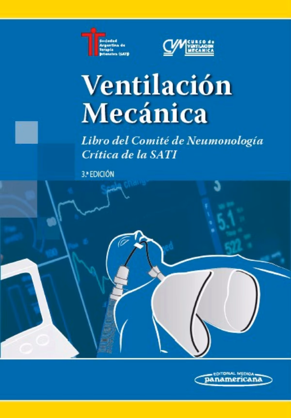 ¿Cuál es el capítulo de ventilación mecánica?