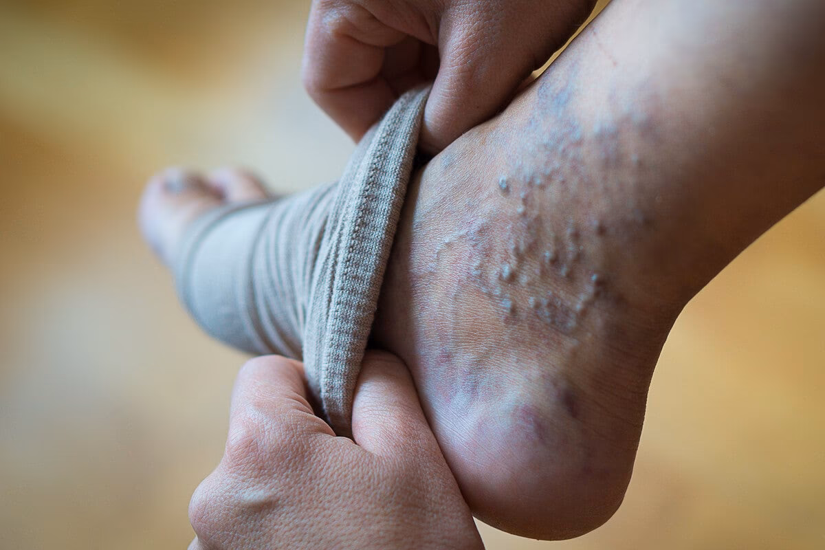 ¿Qué es la compresión y para qué sirve?