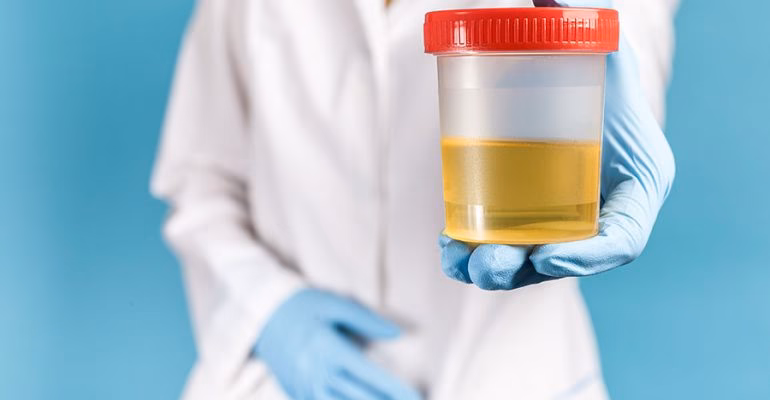 ¿Por qué es importante estar antes de las 8 hs de la mañana en el laboratorio para la determinación de cortisol?